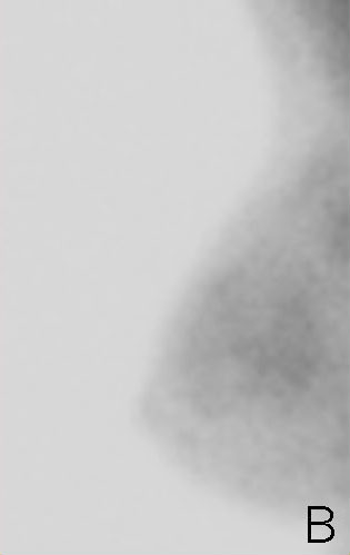 assessing image b
