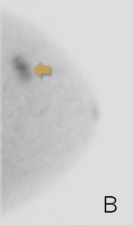 high risk screening image b